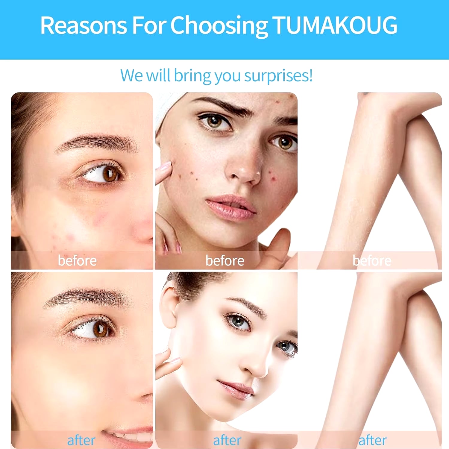 4 in 1 High Frequency Skin Therapy Wand Machine Microcurrent Massage Skin Rejuvenation Tightening Wrinkle Reducing Tool